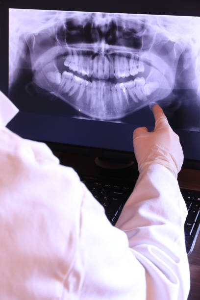 Best Emergency Root Canal Treatment in Goldendale, WA