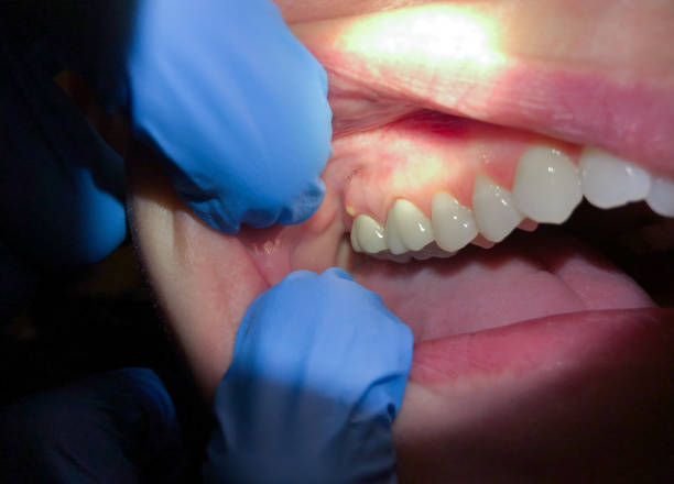Best Weekend Emergency Dentist in Goldendale, WA