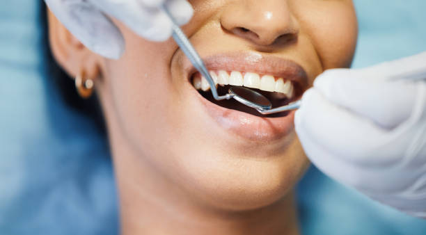 Best Emergency Treatment for Toothache in Goldendale, WA